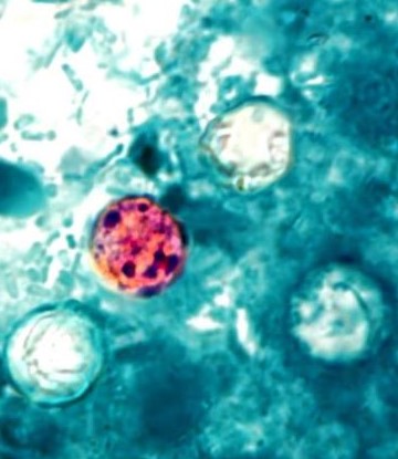 4 cyclospora on slide underneath microscope